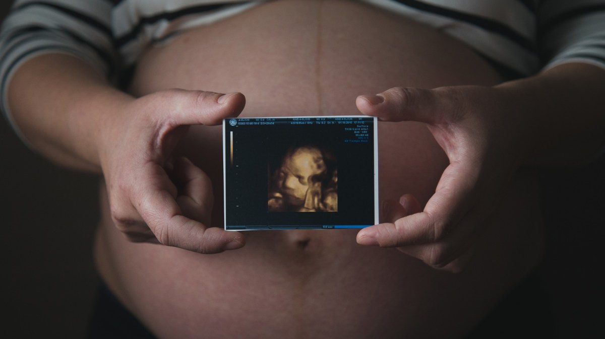 Eine schwangere Frau hält ein 3-D-Ultraschallbild vor ihren Bauch.