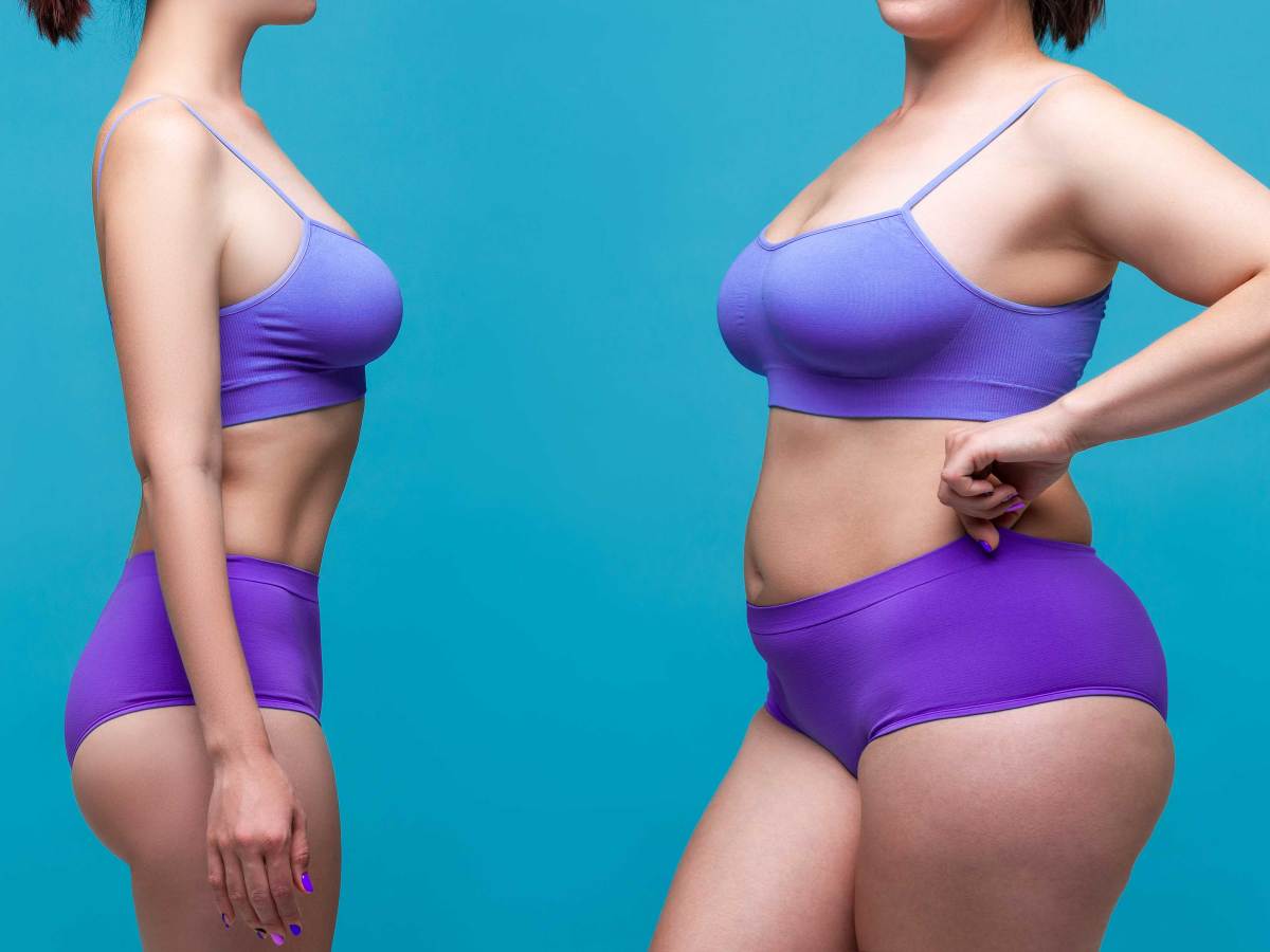Symbolbild zu Abnehmerfolg: Vorher- / Nachher-Bild einer weiblichen Person
