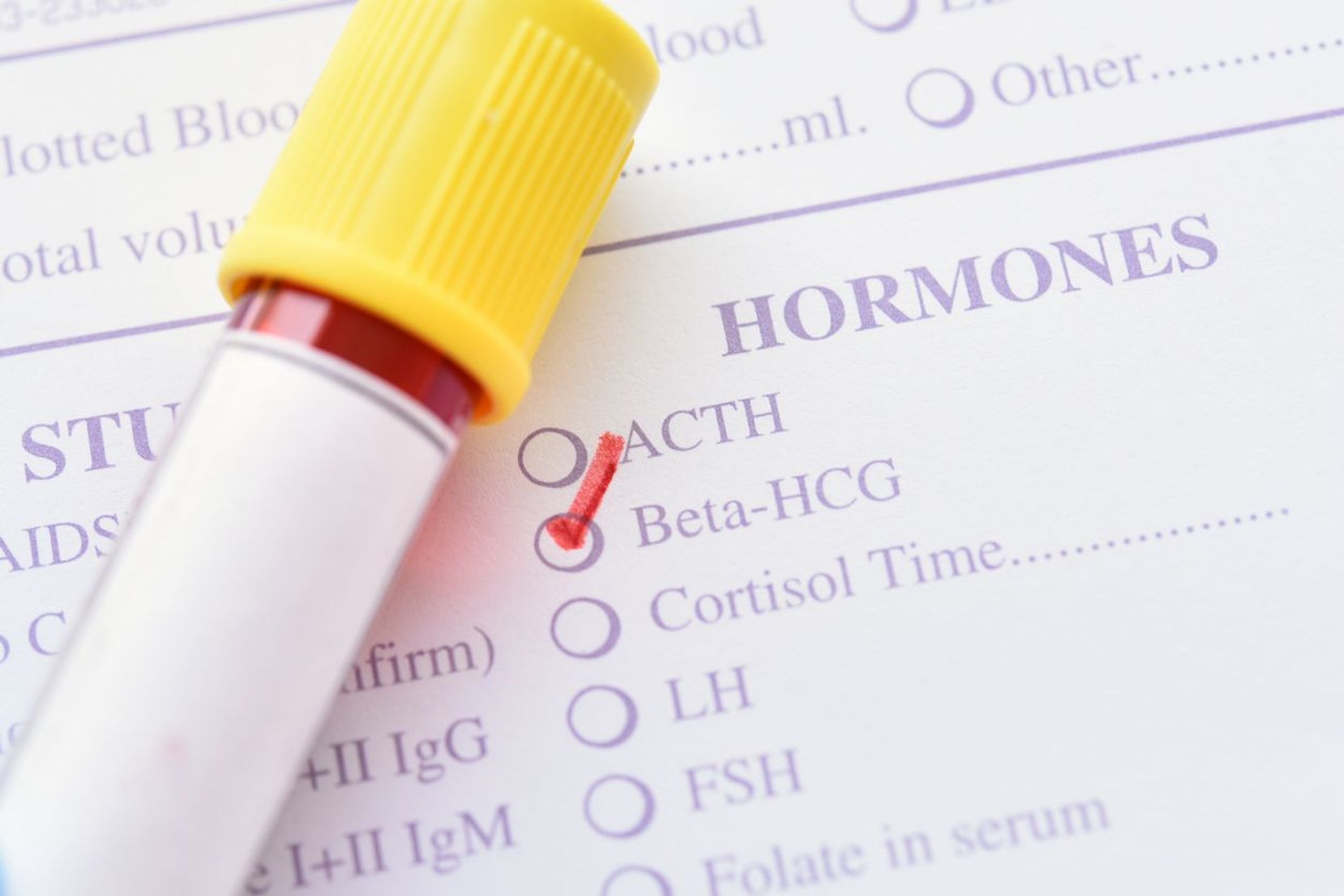 Schwangerschaft: Das verrät der Beta-hCG-Bluttest
