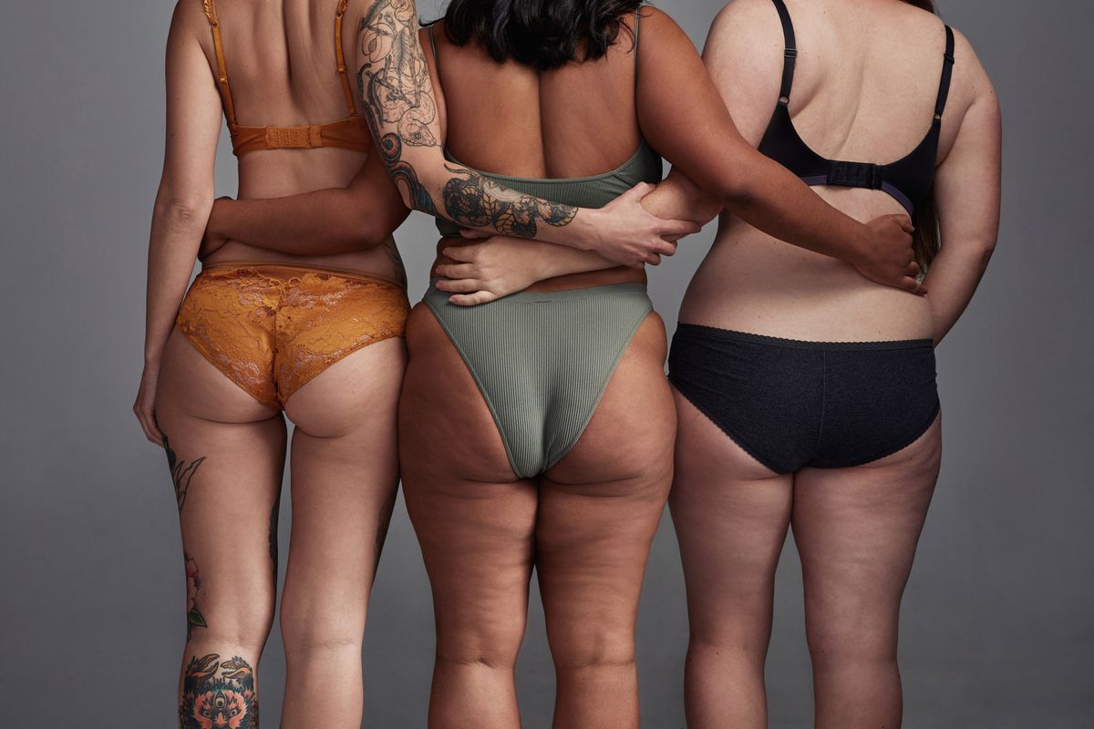 Orangenhaut: Deshalb haben manche Frauen Cellulite