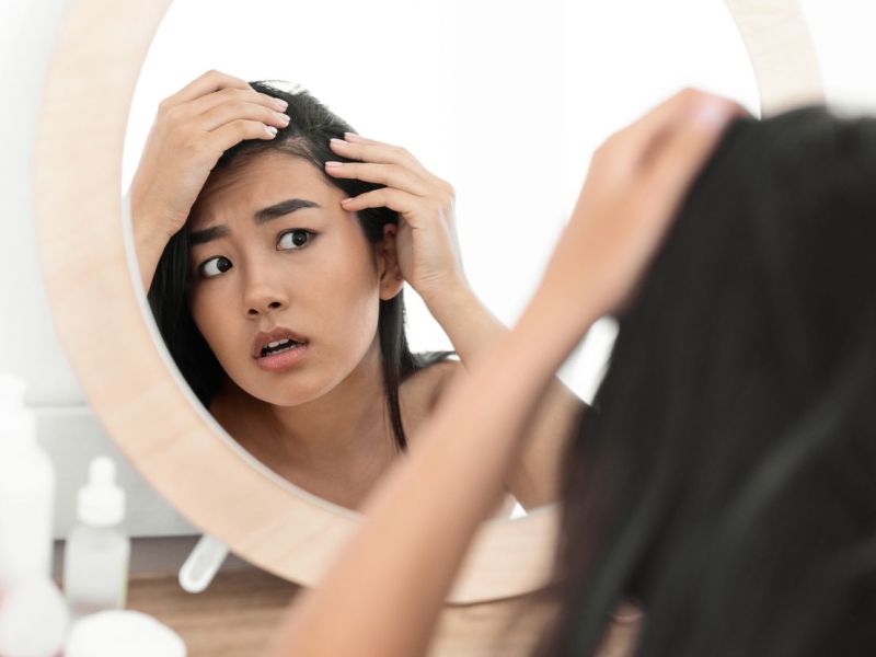 Diese SOS-Tipps helfen gegen lichter werdendes Haar an den Schläfen.