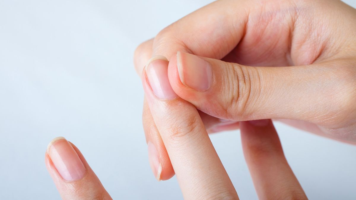 Nagelverfärbungen können durch äußere Einflusse oder Krankheiten ausgelöst werden.