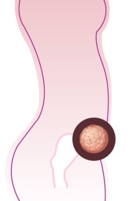 Entwicklung-Embryo, Entwicklung-Baby: 5 SSW (Schwangerschaftswoche)