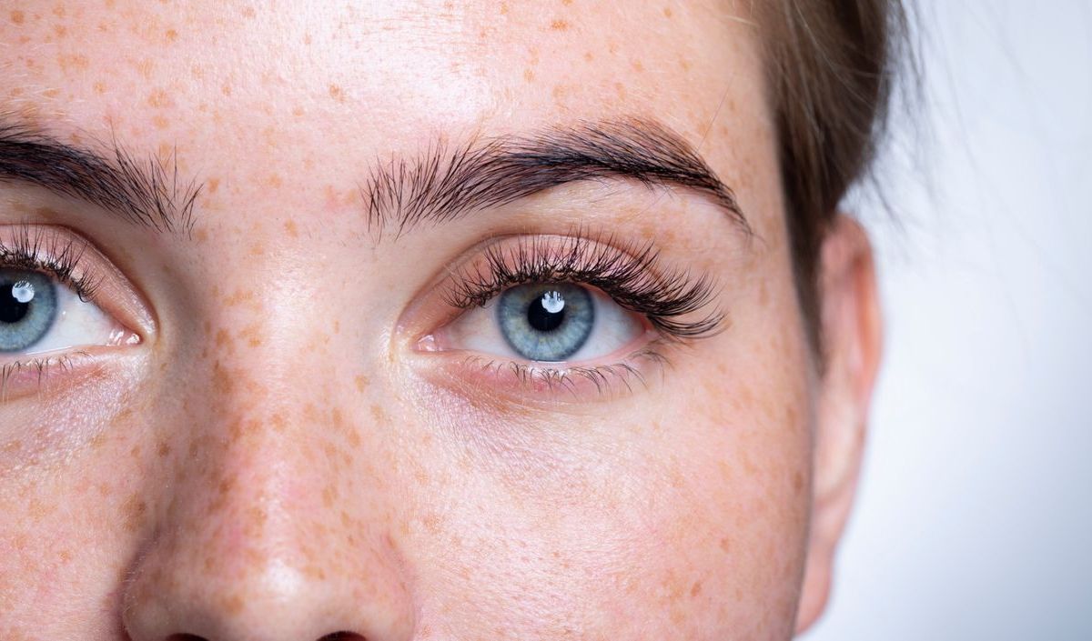 Nahaufnahme von Frau mit blauen Augen und Sommersprossen