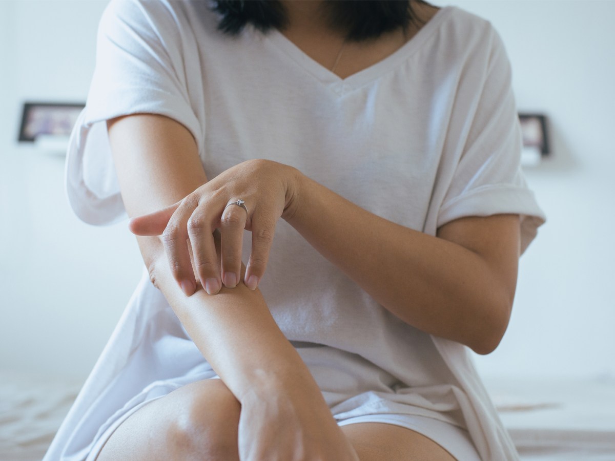 Frau, die sich ihre juckenden Arme kratzt