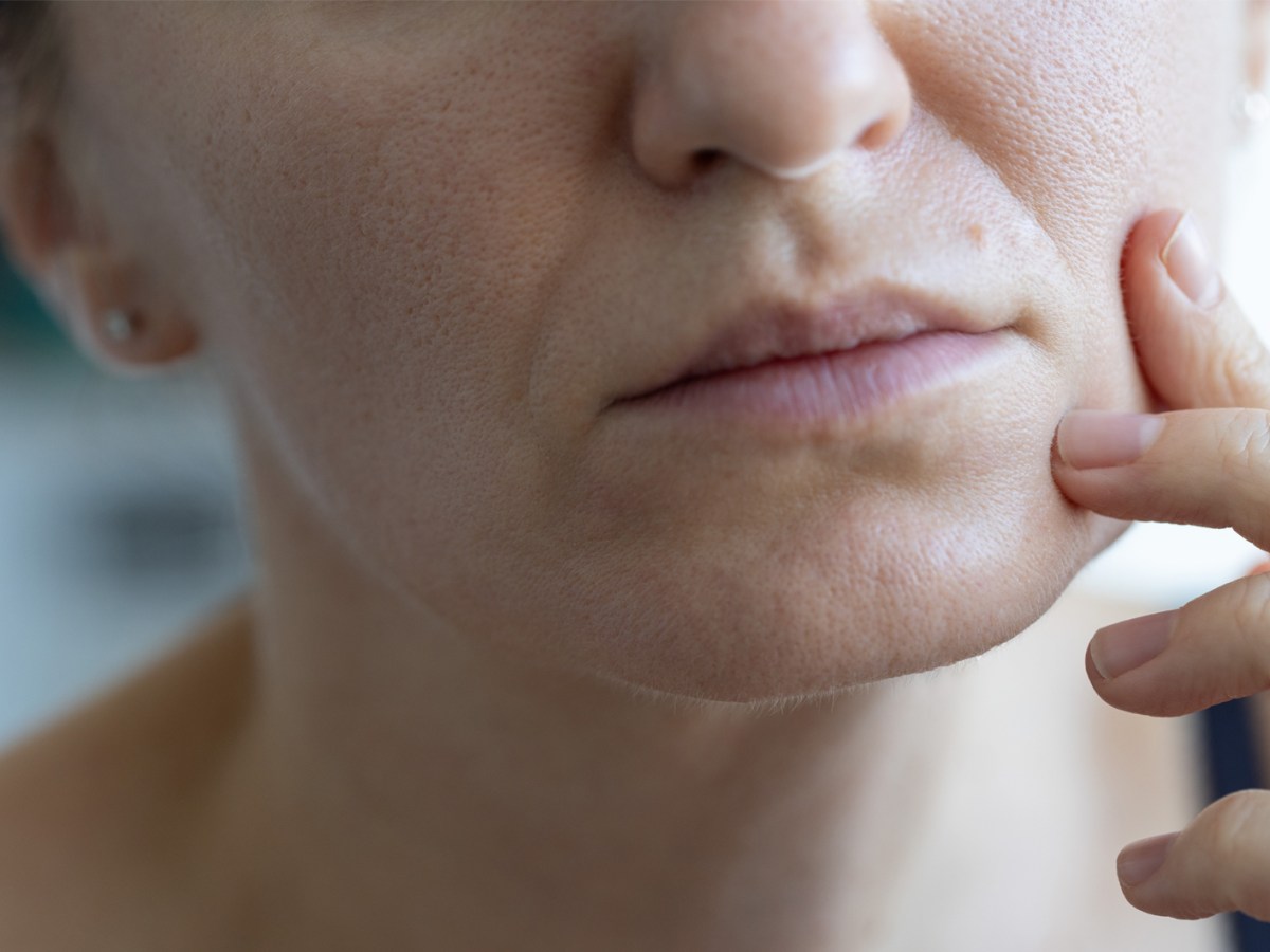 Frau mit tiefen Falten und großen Poren.