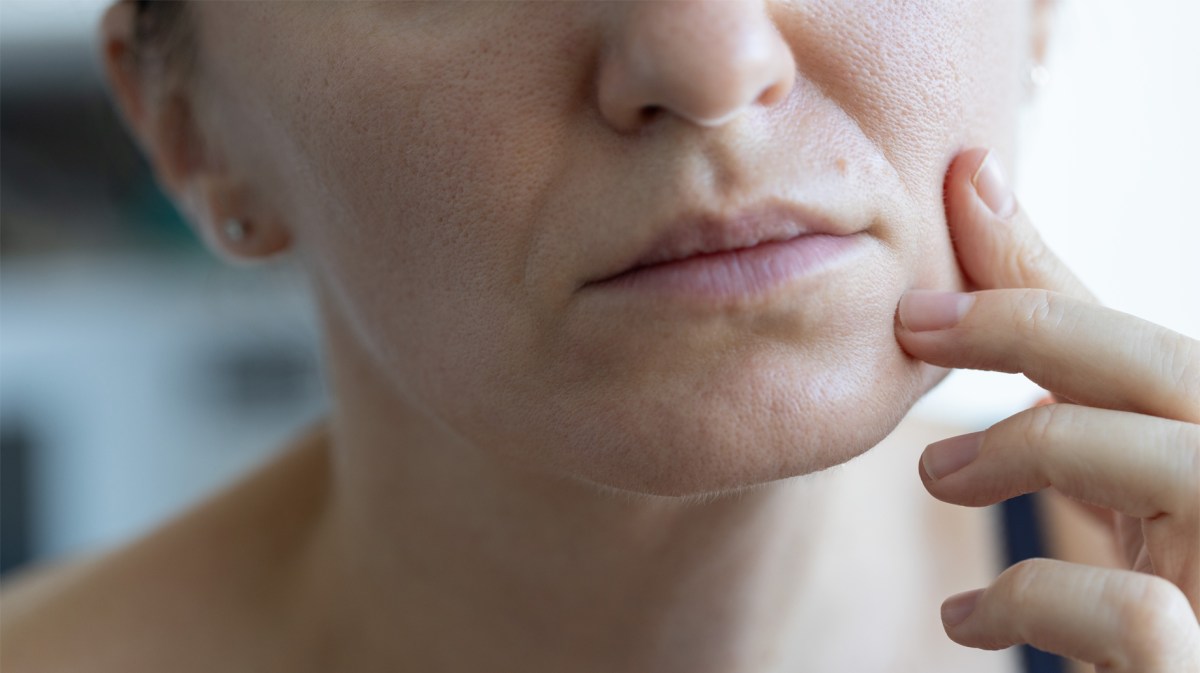 Frau mit tiefen Falten und großen Poren.