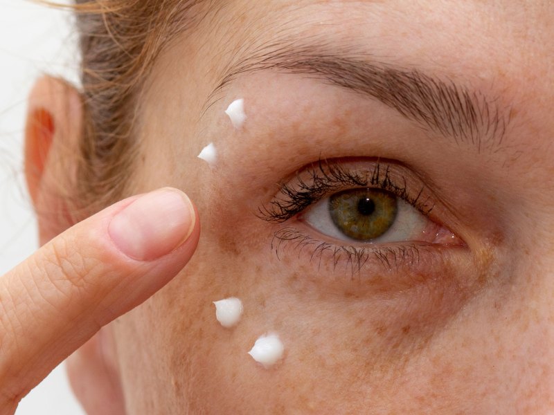 Frau, die eine Creme um die Falten ihrer Augen aufträgt.