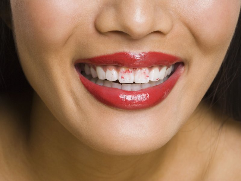 Frau mit rotem Lippenstift und Lippenstift-Flecken auf den Zähnen.
