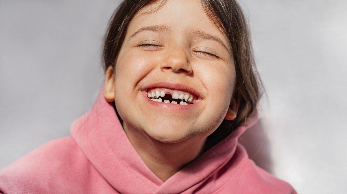 Porträt eines lachenden Kindes mit einer Zahnlücke.
