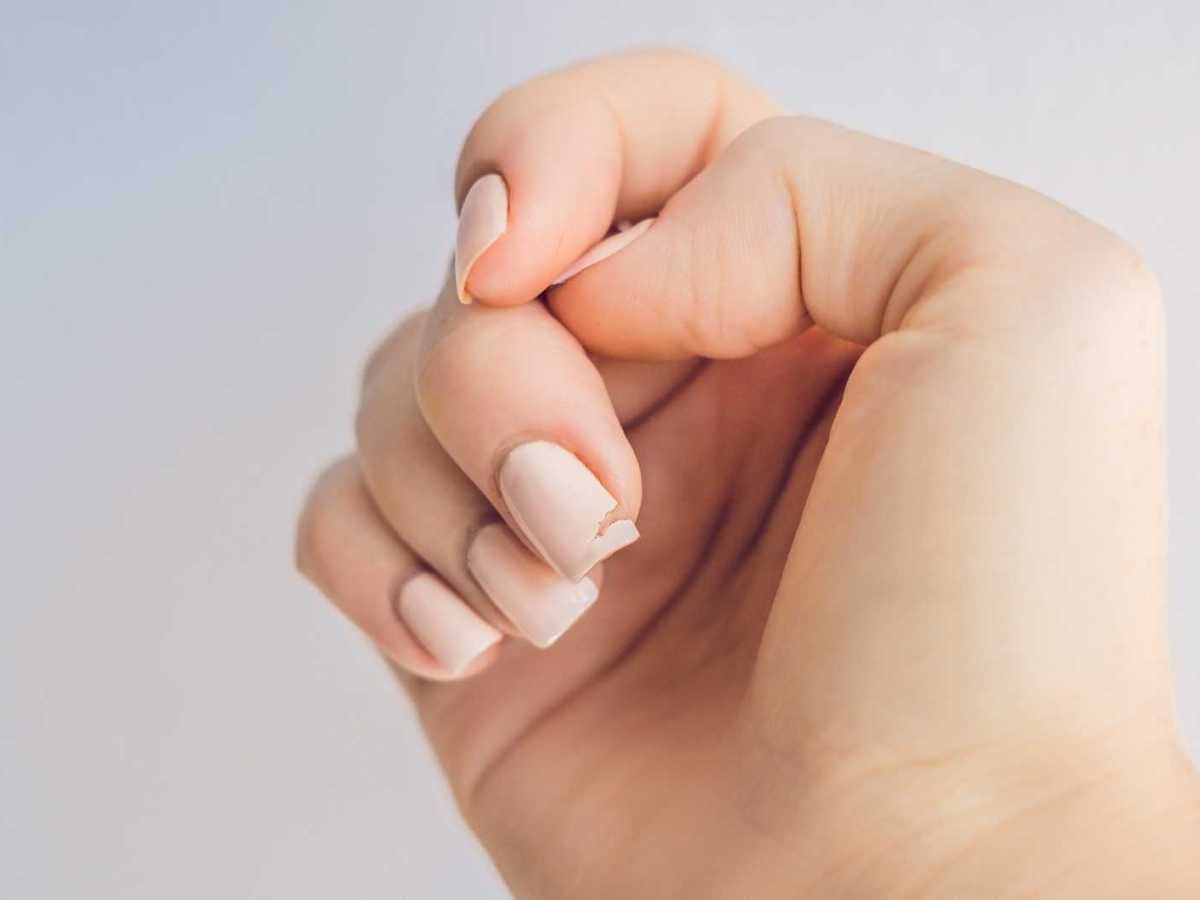 Rosa lackierte Fingernägel, von denen einer eingerissen ist