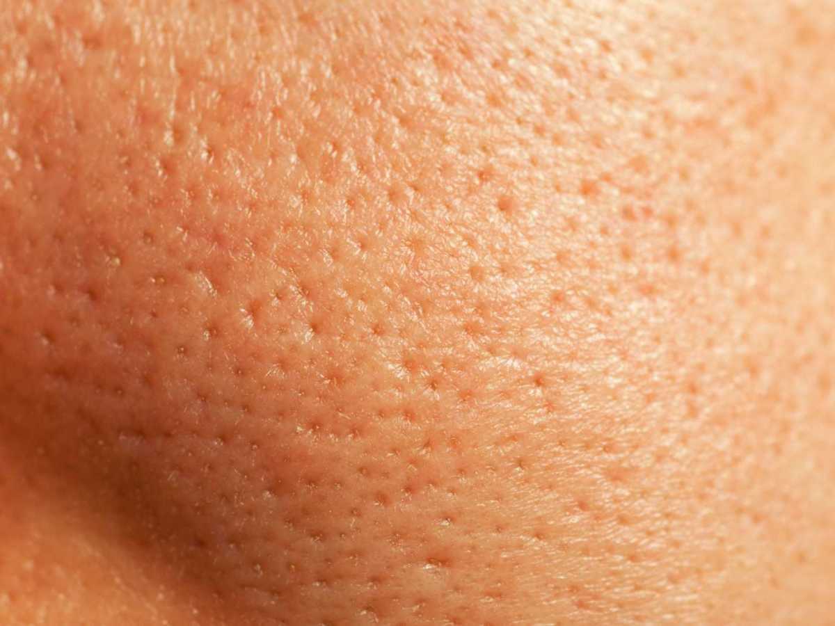 Glatte Haut trotz gro&szlig;er Poren &ndash; mit diesen Make-up-Hacks klappt&rsquo;s.