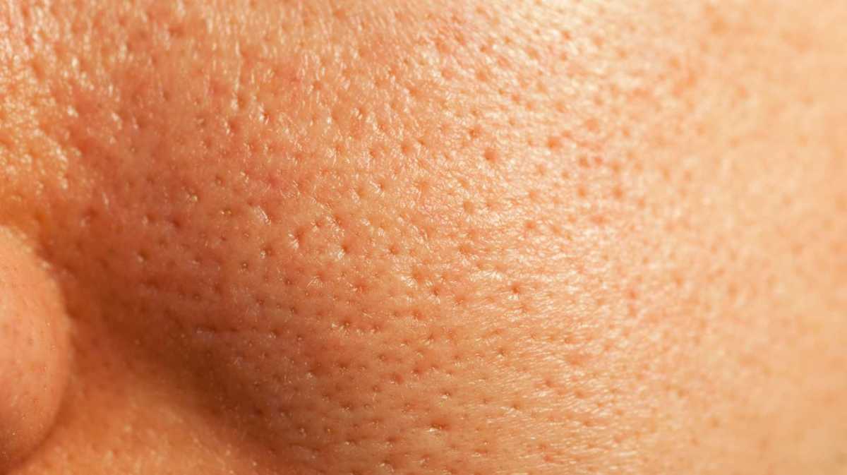 Glatte Haut trotz großer Poren – mit diesen Make-up-Hacks klappt’s.