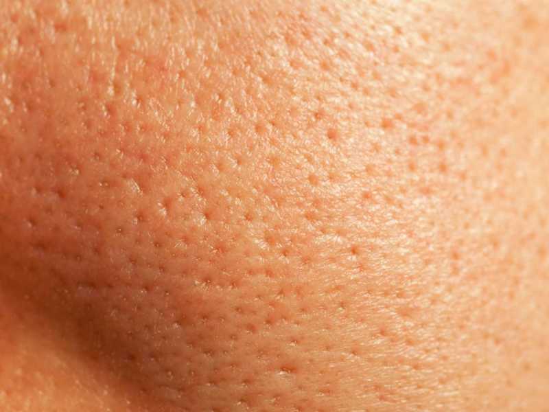 Glatte Haut trotz großer Poren – mit diesen Make-up-Hacks klappt’s.