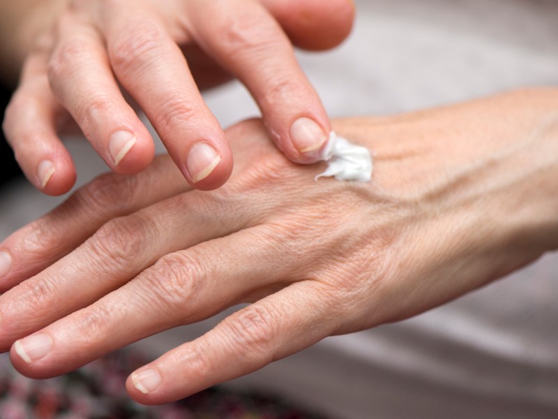 Frau cremt ihre Hände mit Handcreme ein.