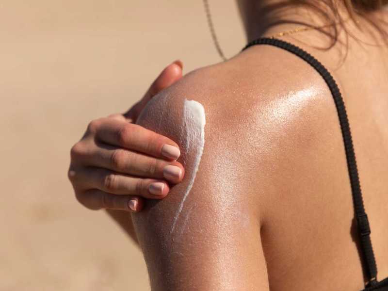 Frau cremt sich die Schulter ein, die der Sonne ausgesetzt war