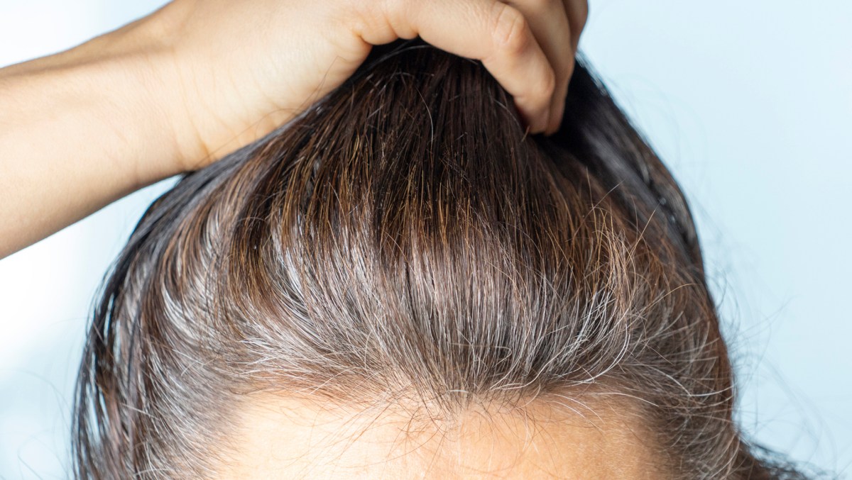 Frau mit grauen Haaren am Haaransatz.