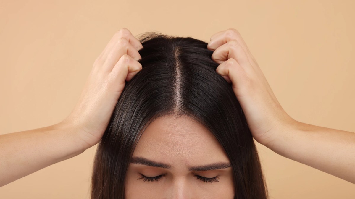 Junge Frau mit dunklen Haaren kratzt sich an ihrer Kopfhaut, weil diese trocken ist.
