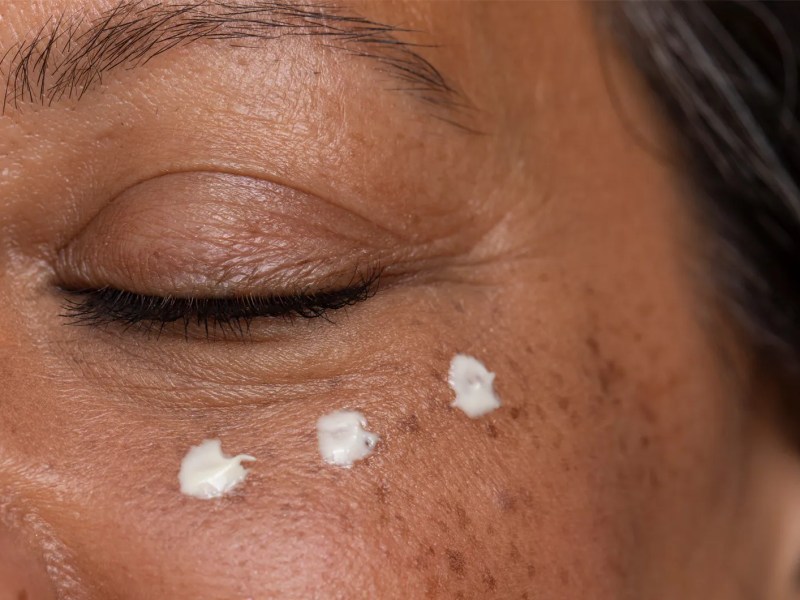 Frau, die unter den Augen 3 Tropfen einer Creme aufgetragen hat.