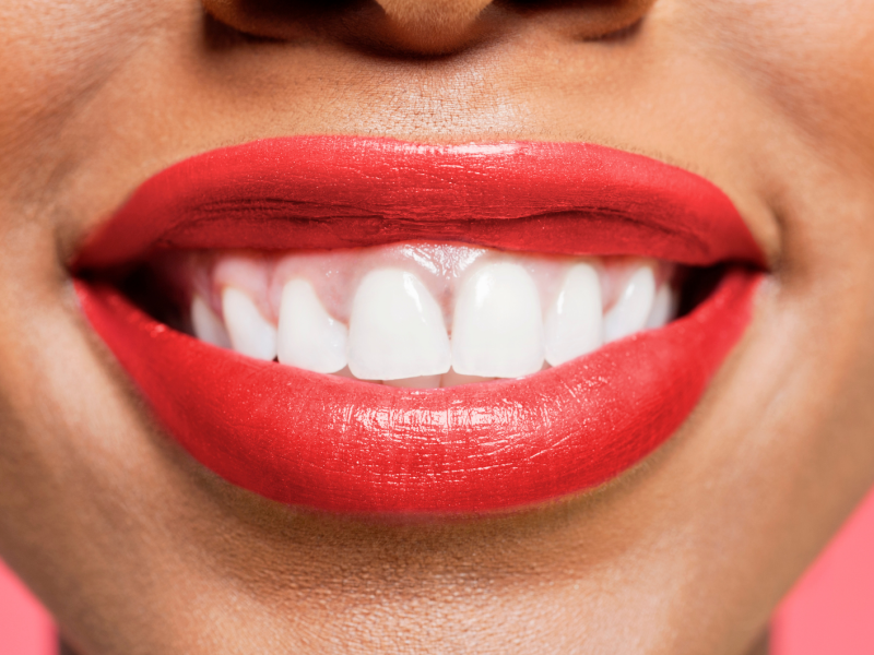 Lachender Mund mit roten Lippen